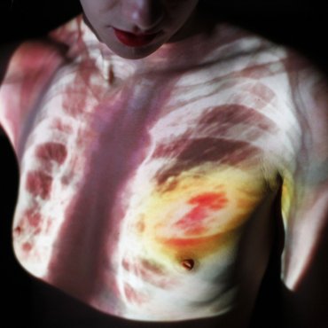 Tumor: karcinogenní romance